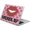 Lips (Pucker Up)  Laptop Skin