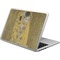 The Kiss (Klimt) - Lovers Laptop Skin - Custom Sized