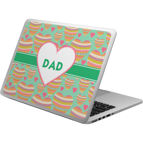 Custom Design - Laptop Skin